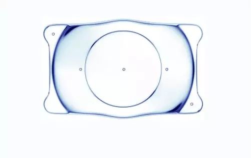 icl晶体植入术的前提条件必看！