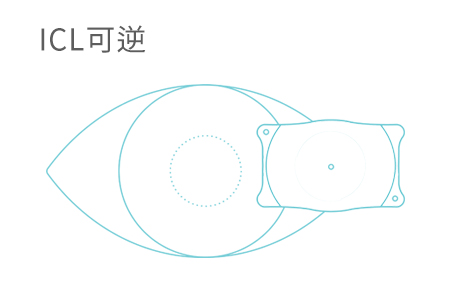 icl晶体很难取出吗？