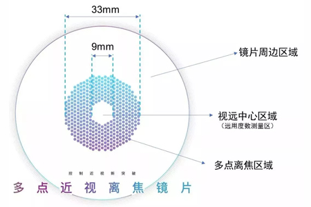 近视离焦眼镜的作用 你真的了解吗？