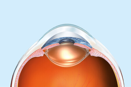 视网膜脱落能治好吗？视网膜脱落手术多久可以恢复？