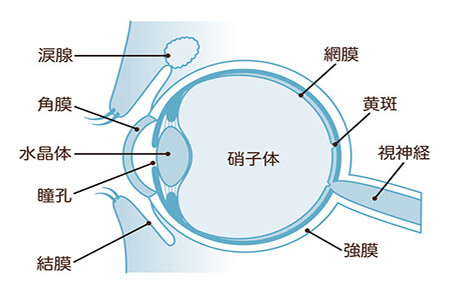 视网膜脱离 专家提醒：这种眼科疾病要重视！