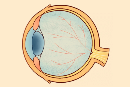 视网膜脱落的症状？