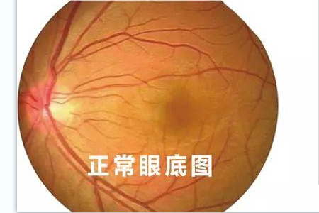 ​沃瑞眼科为您解读全飞秒近视手术的原理是怎样的？