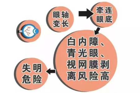 全飞秒近视手术价格哪家好？