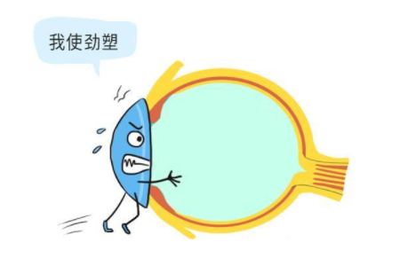 合肥沃瑞眼科医院的梦戴维角膜塑形镜好吗？