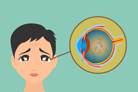 玻璃体混浊可以恢复吗？