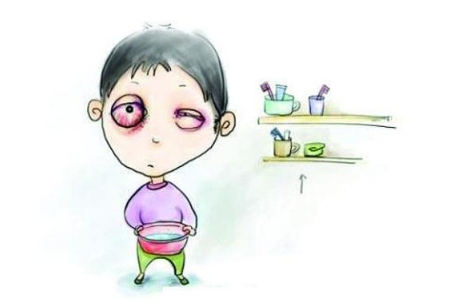 细菌性结膜炎怎么治疗好得快呢？