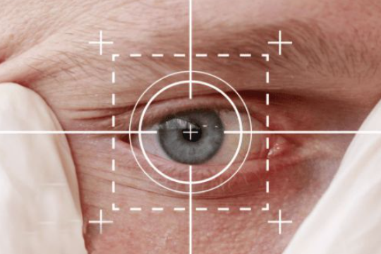 高中生可以做ICL晶体植入术吗？