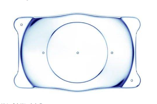 ICL人工晶体植入术中的晶体度数如何确定呢？