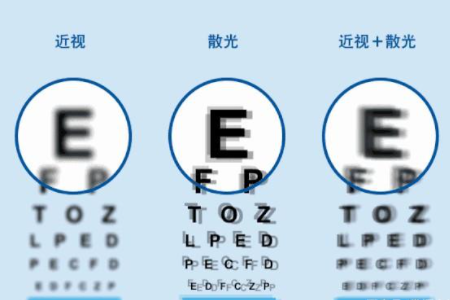 视力表对应近视度数说明？