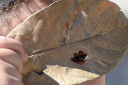 眼睛泪道堵塞手术多少钱？