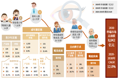 眼科医疗行业高景气度 千亿级市场尽收“眼”底