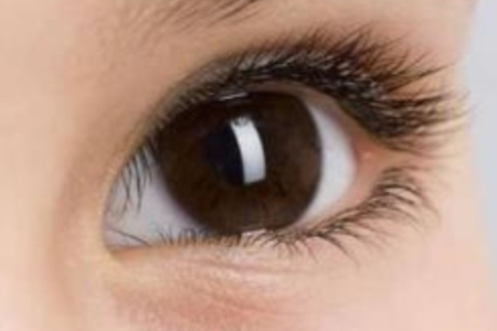 激光近视手术和ICL晶体植入哪个更好？