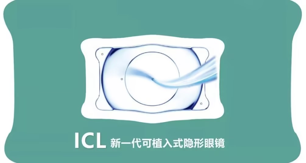 合肥ICL晶体植入近视手术，您了解多少？